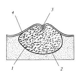 Екатерина Константинова - Лечение болезней и дефектов кожи. И жировик исчез, и...