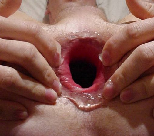 Серж Погорелый - Очень глубокий фистинг с илюстрациями (v.2) 2017г