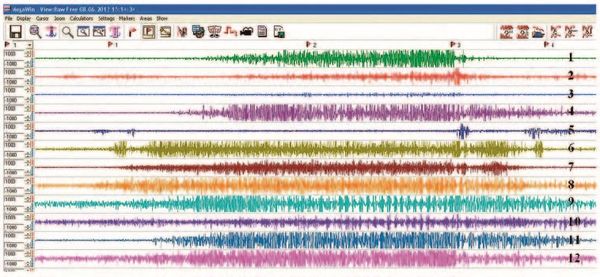 Вячеслав Шляхтов, Руслан Городничев - Физиология силы