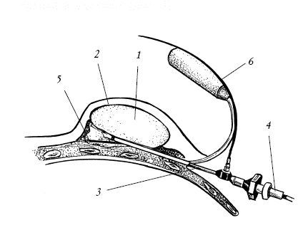 Екатерина Константинова - Лечение болезней и дефектов кожи. И жировик исчез, и...