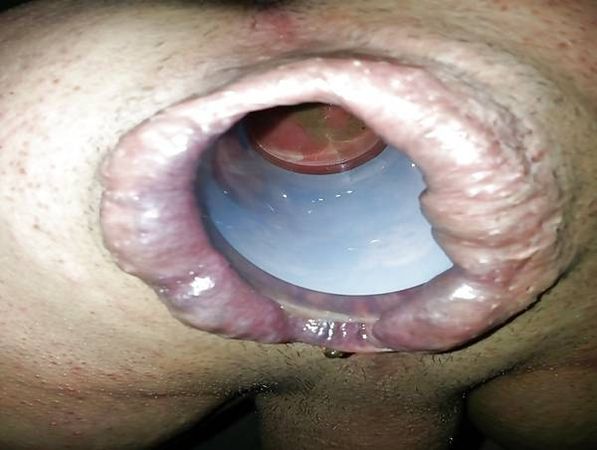 Серж Погорелый - Очень глубокий фистинг с илюстрациями (v.2) 2017г