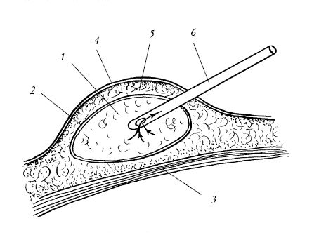 Екатерина Константинова - Лечение болезней и дефектов кожи. И жировик исчез, и...