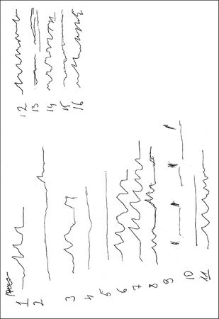 Анастасия Черкасова, Дмитрий Яничев - Особенности дифференциальной диагностики...