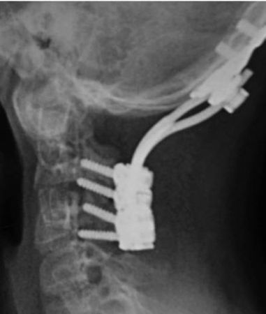 Александр Губин - Острая кривошея у детей: Пособие для врачей
