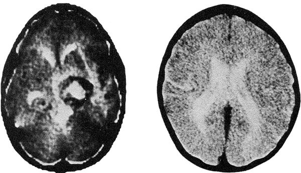 Патрисия Норрис, Гэррет Портер - Я выбираю жизнь. Целительная сила человеческого духа