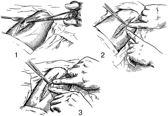 В. Лебедев, Геннадий Семенов - Топографическая анатомия и оперативная хирургия...