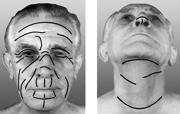 В. Лебедев, Геннадий Семенов - Топографическая анатомия и оперативная хирургия...