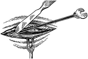 В. Лебедев, Геннадий Семенов - Топографическая анатомия и оперативная хирургия...