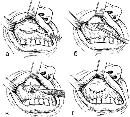 В. Лебедев, Геннадий Семенов - Топографическая анатомия и оперативная хирургия...