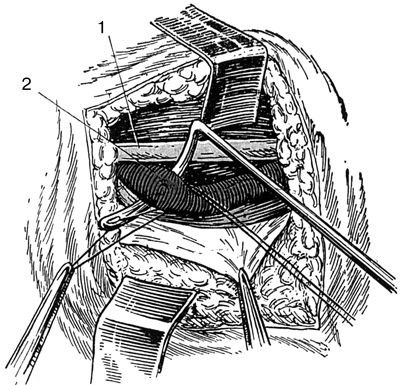 В. Лебедев, Геннадий Семенов - Топографическая анатомия и оперативная хирургия...