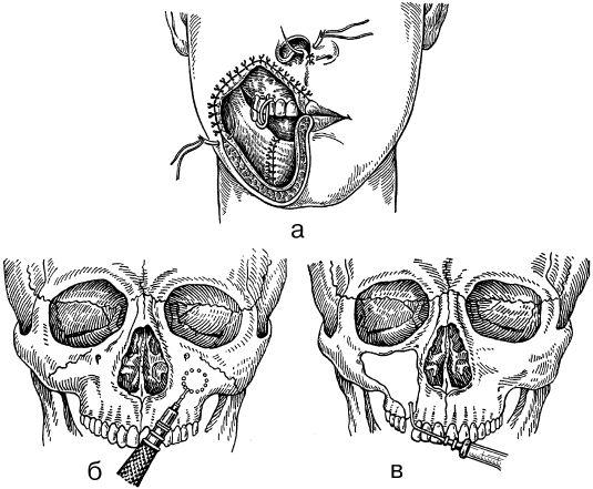 В. Лебедев, Геннадий Семенов - Топографическая анатомия и оперативная хирургия...
