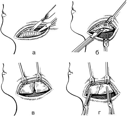 В. Лебедев, Геннадий Семенов - Топографическая анатомия и оперативная хирургия...