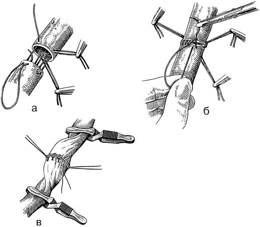 В. Лебедев, Геннадий Семенов - Топографическая анатомия и оперативная хирургия...