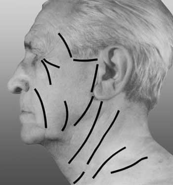 В. Лебедев, Геннадий Семенов - Топографическая анатомия и оперативная хирургия...