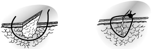 В. Лебедев, Геннадий Семенов - Топографическая анатомия и оперативная хирургия...