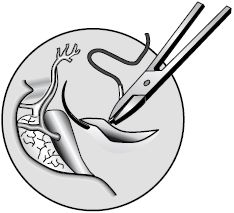 В. Лебедев, Геннадий Семенов - Топографическая анатомия и оперативная хирургия...