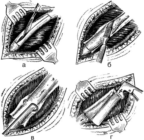 В. Лебедев, Геннадий Семенов - Топографическая анатомия и оперативная хирургия...