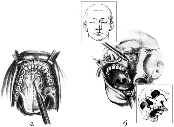 В. Лебедев, Геннадий Семенов - Топографическая анатомия и оперативная хирургия...