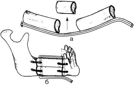 В. Лебедев, Геннадий Семенов - Топографическая анатомия и оперативная хирургия...
