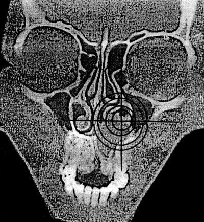 В. Лебедев, Геннадий Семенов - Топографическая анатомия и оперативная хирургия...