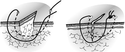 В. Лебедев, Геннадий Семенов - Топографическая анатомия и оперативная хирургия...