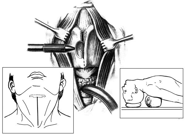 В. Лебедев, Геннадий Семенов - Топографическая анатомия и оперативная хирургия...
