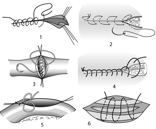В. Лебедев, Геннадий Семенов - Топографическая анатомия и оперативная хирургия...