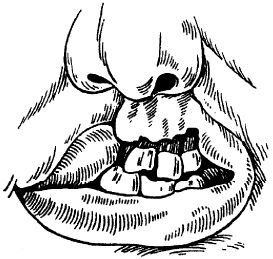 В. Лебедев, Геннадий Семенов - Топографическая анатомия и оперативная хирургия...