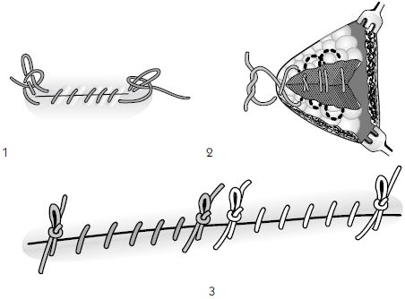 В. Лебедев, Геннадий Семенов - Топографическая анатомия и оперативная хирургия...