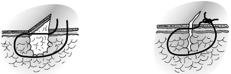 В. Лебедев, Геннадий Семенов - Топографическая анатомия и оперативная хирургия...