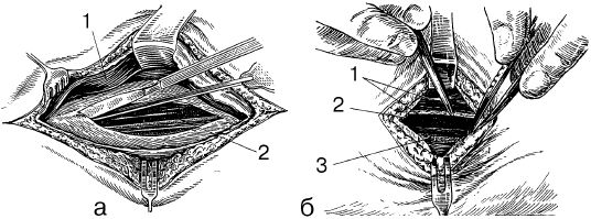 В. Лебедев, Геннадий Семенов - Топографическая анатомия и оперативная хирургия...