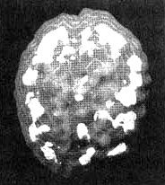 Дэниел Амен - Измените мозг - изменится и жизнь!