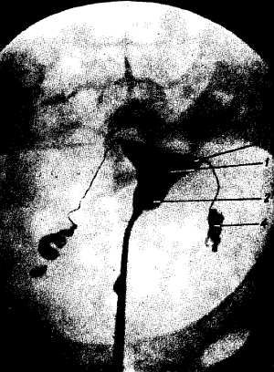 Михаил Привес, Николай Лысенков и др. - Анатомия человека