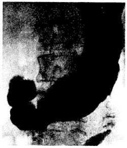 Михаил Привес, Николай Лысенков и др. - Анатомия человека