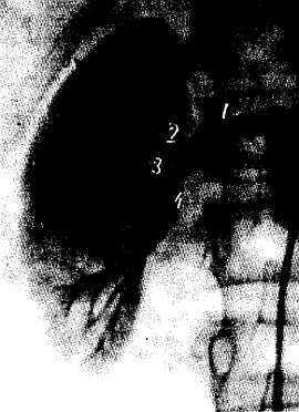 Михаил Привес, Николай Лысенков и др. - Анатомия человека