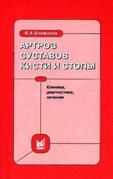 читать Артроз суставов кисти и стопы: клиника, диагностика, лечение