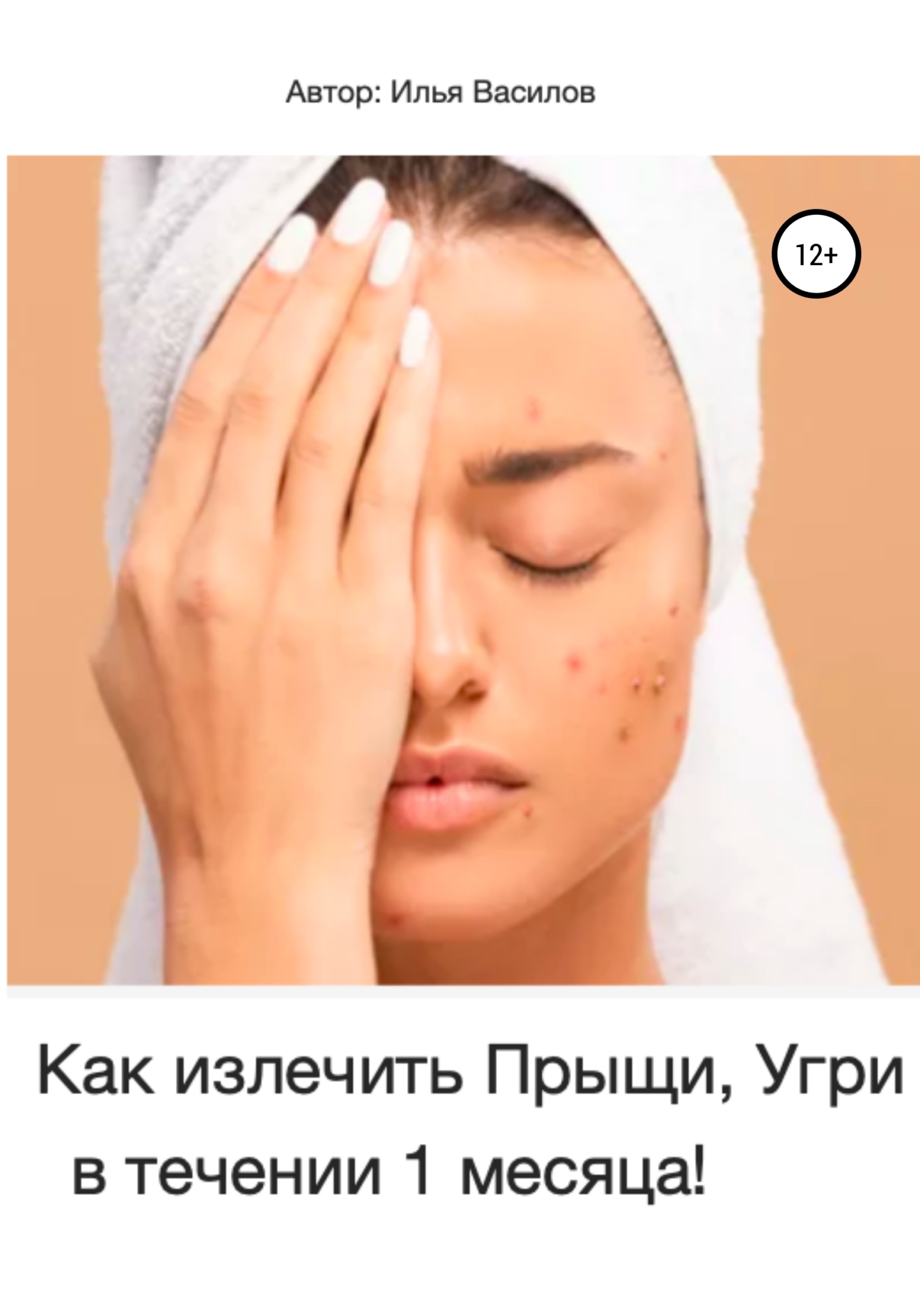 читать Как излечить прыщи, угри в течении 1 месяца!