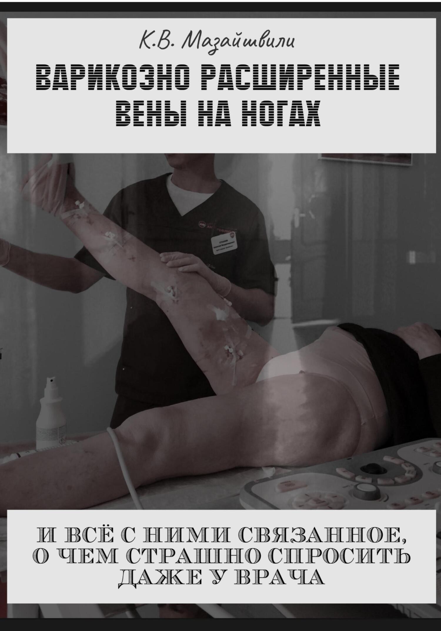 читать Варикозно расширенные вены на ногах и всё с ними связанное, о чём страшно спросить даже у врача