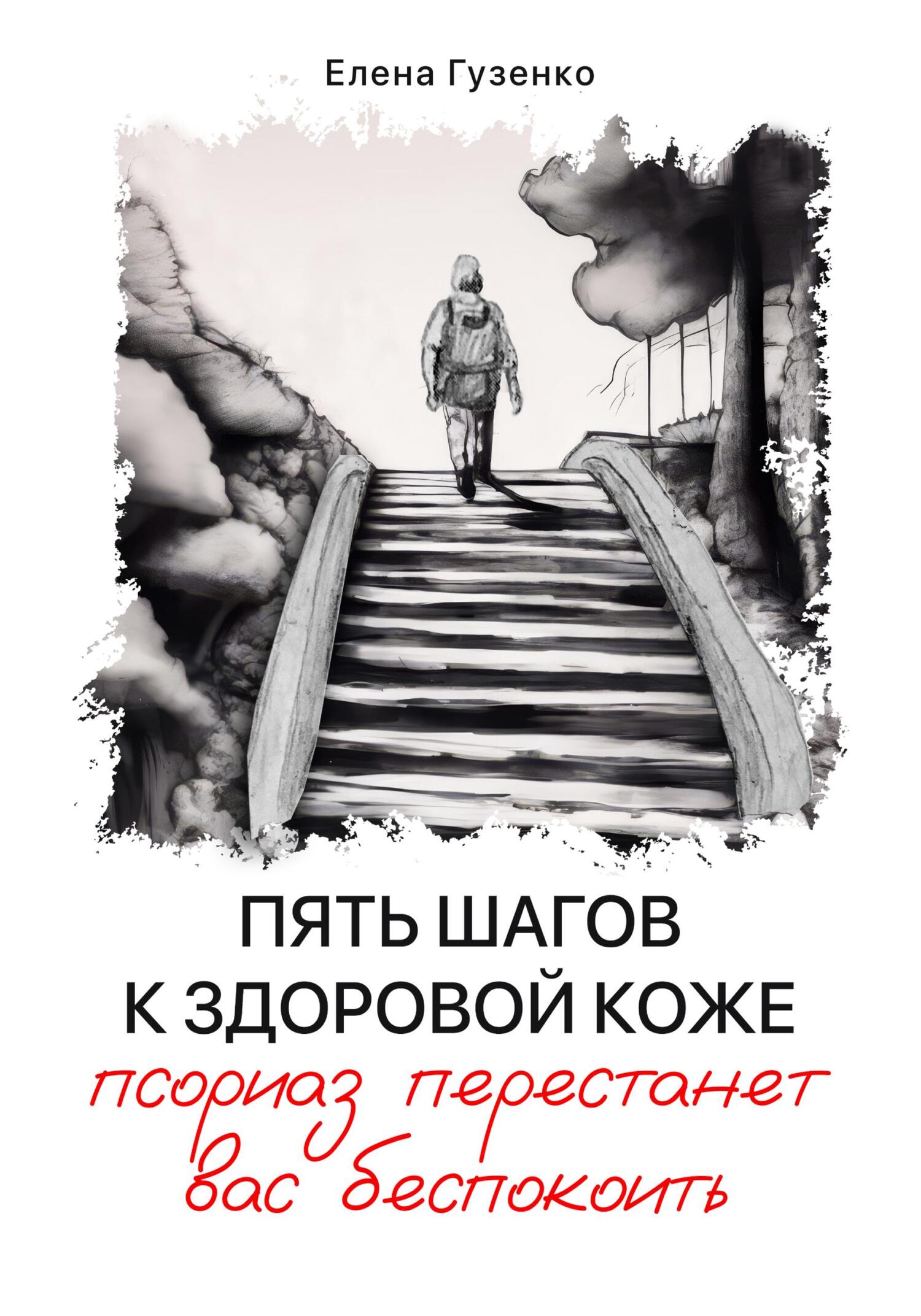 читать Пять шагов к здоровой коже. Псориаз перестанет вас беспокоить