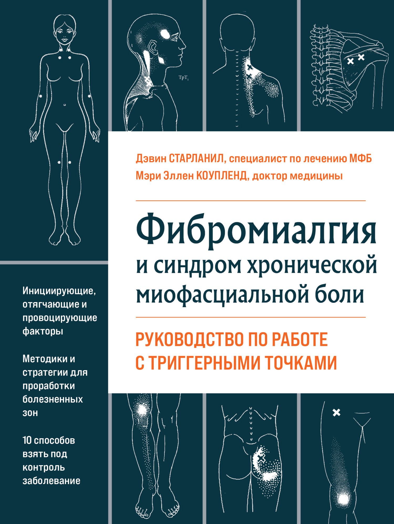 читать Фибромиалгия и хроническая миофасциальная боль