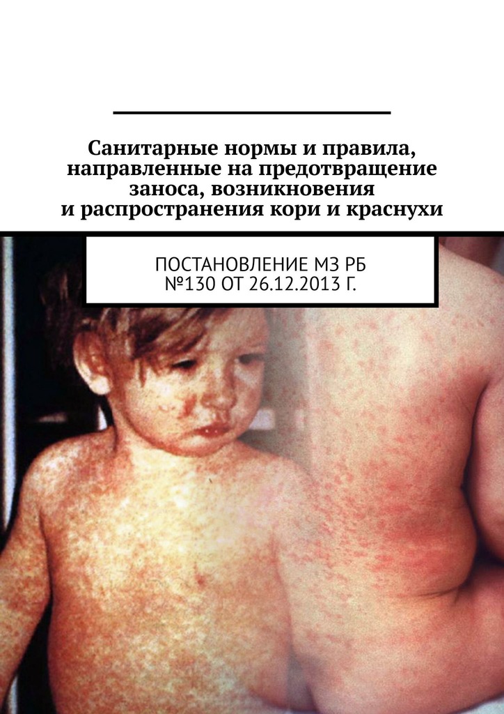 читать Санитарные нормы и правила, направленные на предотвращение заноса, возникновения и распространения кори и краснухи. Постановление МЗ РБ №130 от 26.12.2013 г.