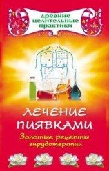 читать Лечение пиявками. Золотые рецепты гирудотерапии