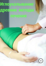 читать Иглоукалывание. Древние методы лечения