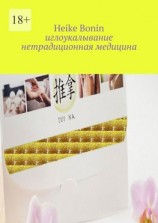 читать Иглоукалывание. Нетрадиционная медицина