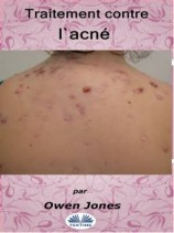читать Traitement Contre L'Acné