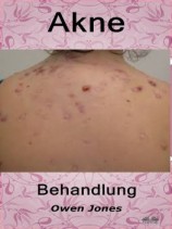 читать Akne-Behandlung