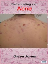читать Behandeling Van Acne
