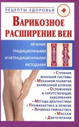 читать Варикозное расширение вен. Лечение традиционными и нетрадиционными методами
