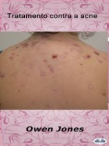 читать Tratamento Contra A Acne